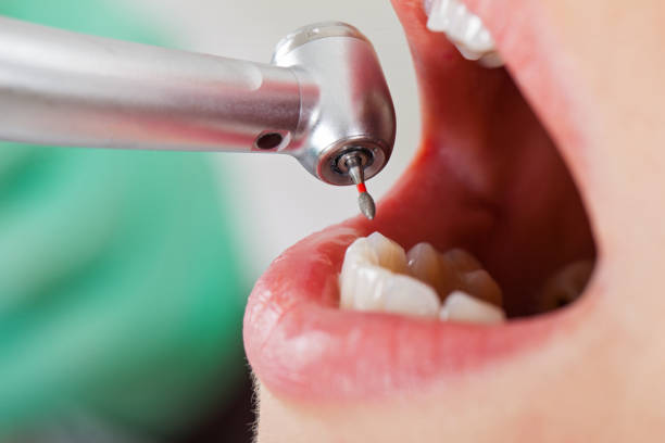Best Emergency Dental Surgery in Lynchburg, TN